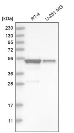 SH3GLB2 Antibody, Novus Biologicals:Antibodies:Primary Antibodies